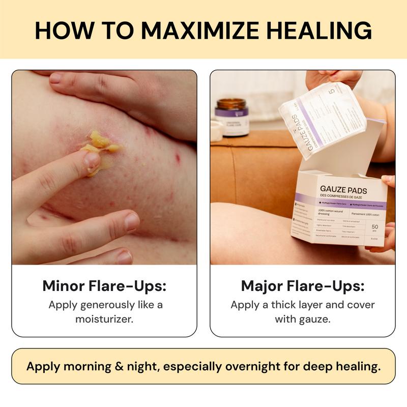 Flare Care & Relief Cream