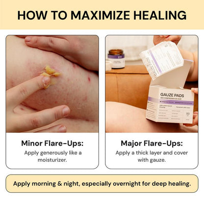 Flare Care & Relief Cream